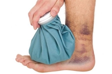 Ayakta Morarma Çeşitleri Ayakta Morarma Çeşitleri